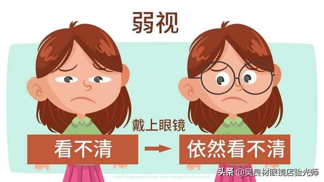 五岁弱视的孩子去哪里治疗比较好？