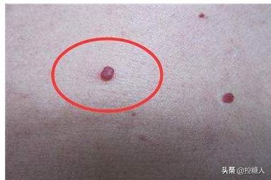 业障重女人的表现,女人肝不好，身体会有哪些表现？如何调养？