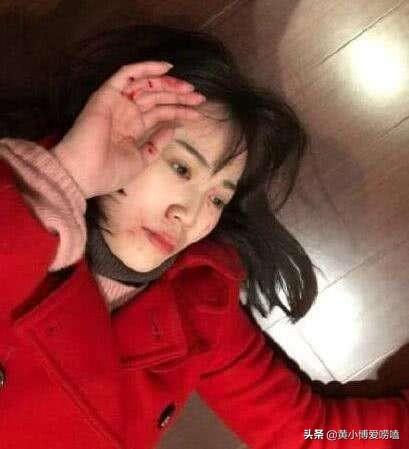 王宝强遇车祸图片:王宝强即将结婚，马蓉会阻止王宝强再婚吗