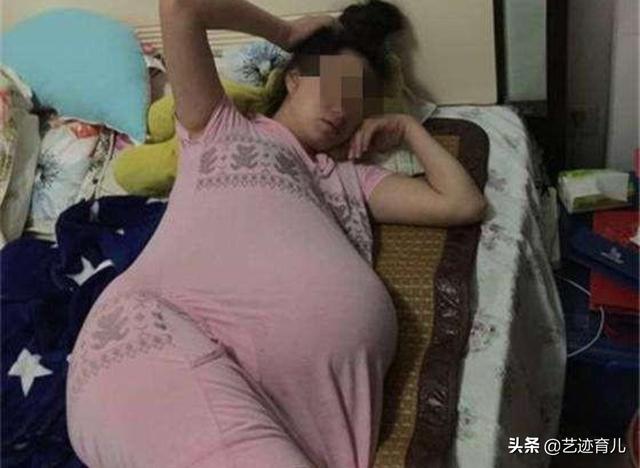 孕中期死胎有什么症状:孕中期死胎是什么原因造成的 胎停多久能发现？会有什么症状？