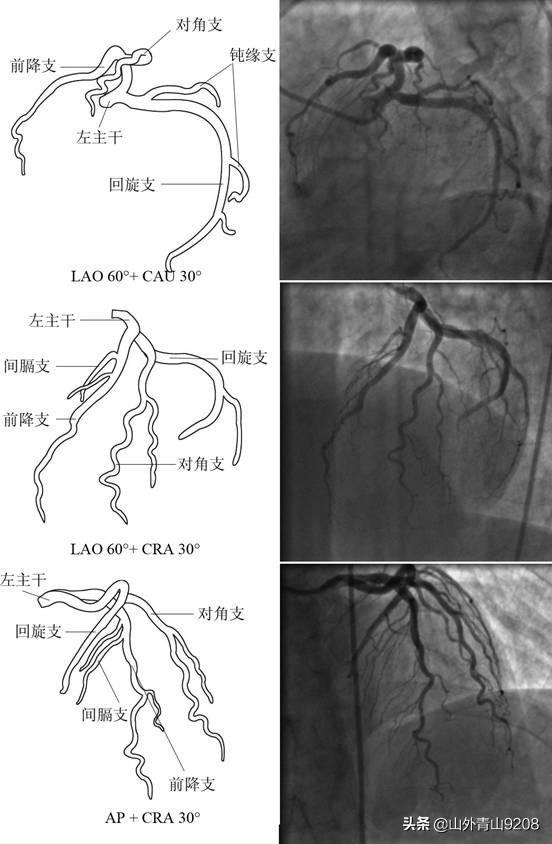 头条问答 - ct显示心脏大血管形态,位置正常,而心电图显示心肌呈缺血