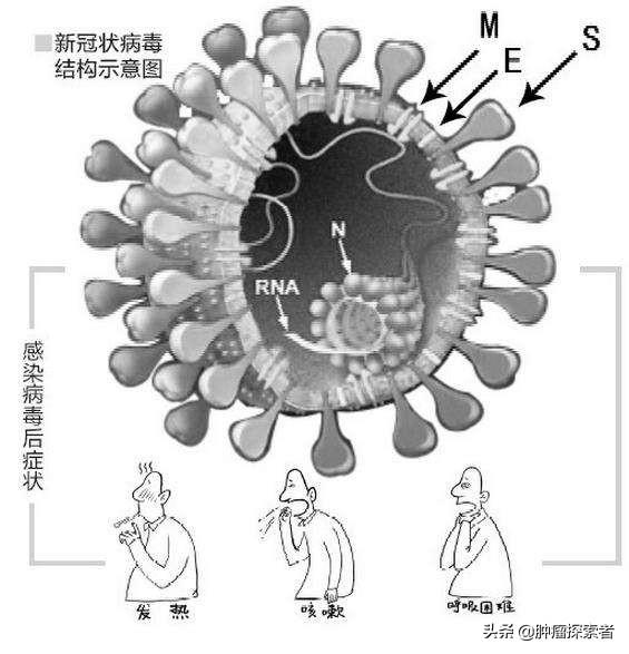 宠物健康之家:家里的宠物会成为传染源么，还能正常遛狗么？ 宠物健康检查表