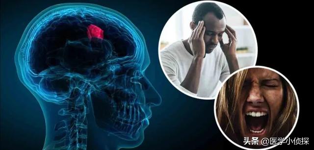 7莱姆病症状太容易被忽视:哪些症状连续出现是癌症的表现？