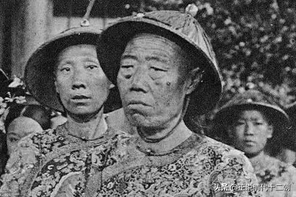坊间流传李莲英是历史上唯一净身手术失败的太监,这是他被宠的原因吗？