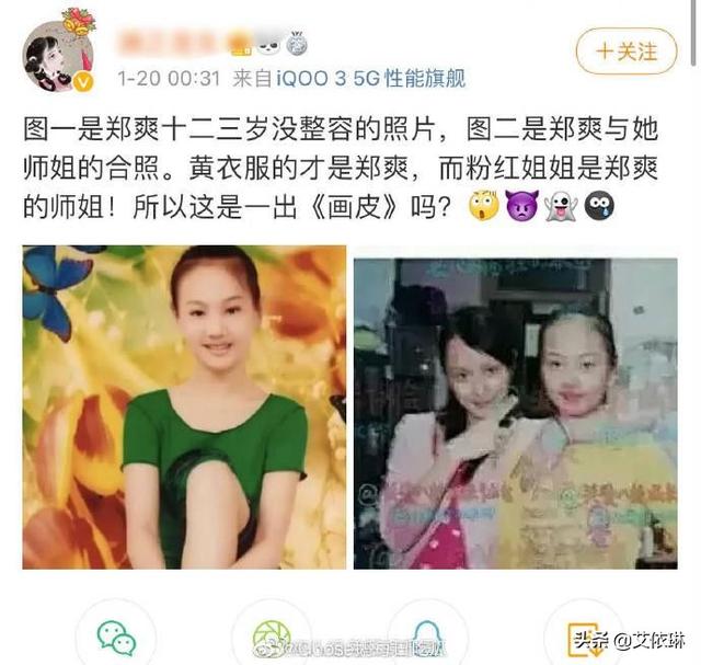 郑爽整容前后照片:像郑爽这样的，以后还能有人要吗？