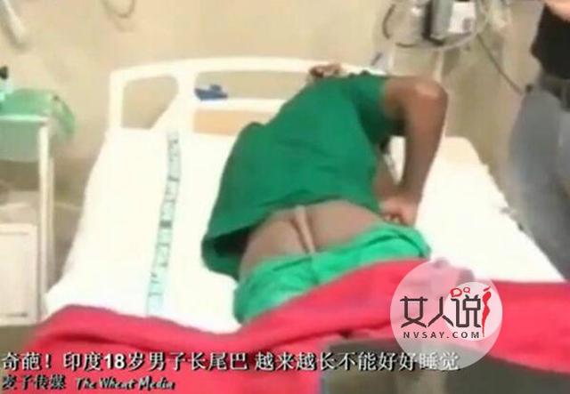 动物尾巴的用处:为什么动物有尾巴，而我们却没有尾巴呢