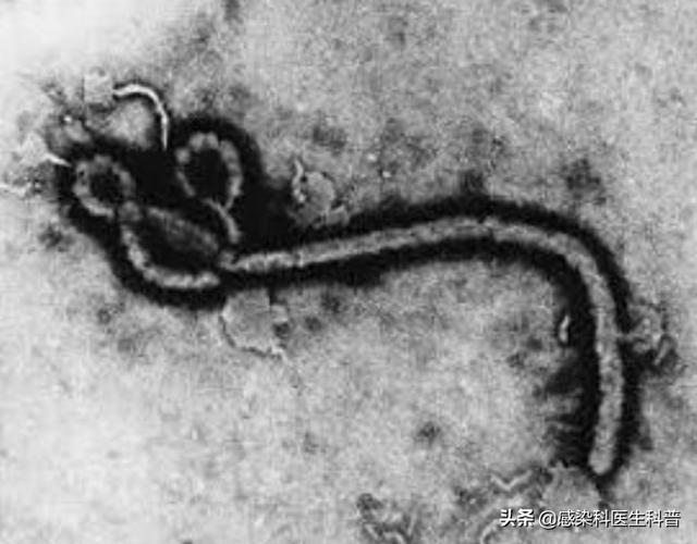 埃博拉吐内脏图:感染埃博拉（Ebola）病毒会怎么样
