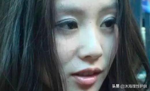 怎样快速去掉抬头纹(如何去抬头纹最好的方法)