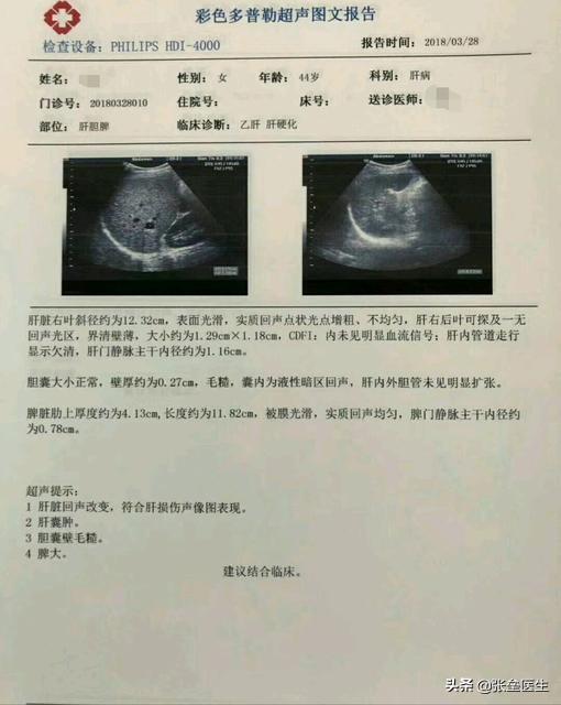 退休后参加饭局，说什么话最掉价