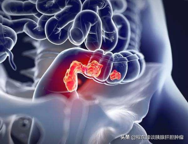 出虚恭:经常放屁到底是好事还是坏事？经常放屁是肠癌的警示吗？