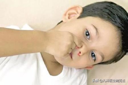 小孩鼻子出血怎么回事,儿童鼻子出血是什么原因