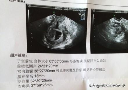 有胎芽是怀孕多少周了，怀孕五周看见胎芽胎心怎么办