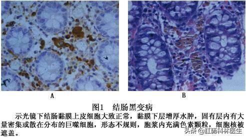 大便入水就散开是怎么回事;大便入水就散是什么原因