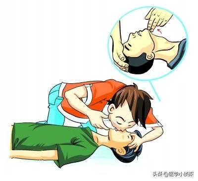 鬼门关:在心脏快要骤停时，有什么急救办法可以把人从鬼门关抢回来？