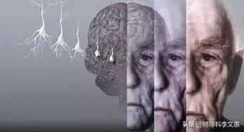 老年痴呆越来越多？医生：坚持4个习惯,老年痴呆会避而远之,是哪四个习惯？