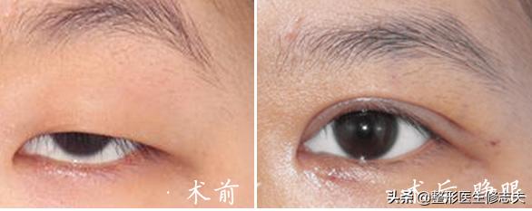 颧骨位置图片,什么长相的女生会看起来显得凶？