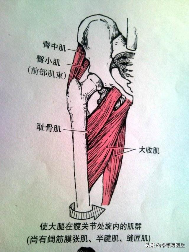 头条问答 - 右侧大腿根部间歇性疼痛,不定时发作,疼痛时间短,是什么