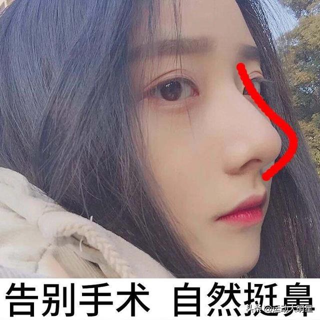 缩小鼻翼的方法,鼻头鼻翼缩小的方法有哪些？
