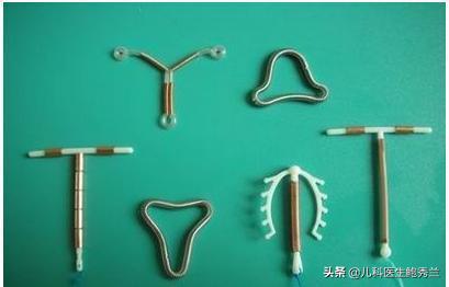 绝育环:上节育环需要什么手续？女性上节育环对身体有什么危害？
