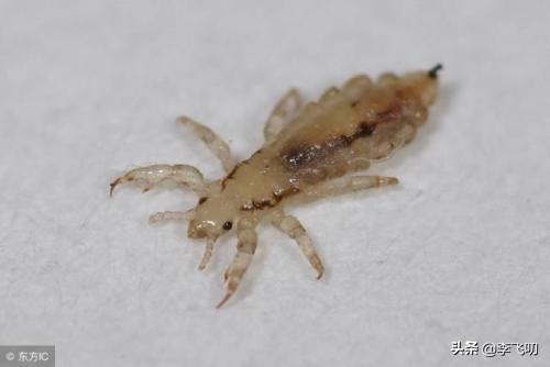农村老话说“穷生虱子,富生疮”,头上的虱子是怎么来的？