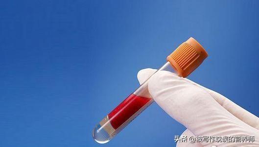 青椒鸡胸脯肉的做法:青椒鸡胸脯肉的做法家常菜 血脂高可以吃鸡胸肉吗？如何做鸡胸肉吃起来才健康？