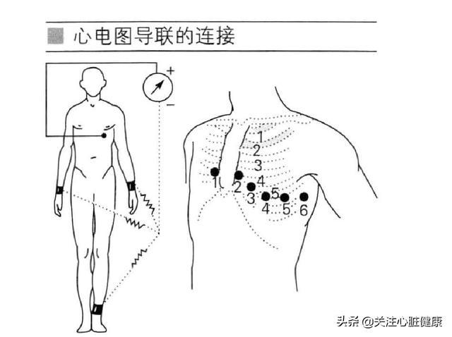 心电图导联位置口诀做心电图时导联位置如何安放