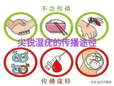 疑似莱姆病症状:得尖锐湿疣的典型症状有哪些？ 莱姆病的症状