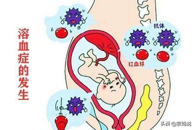 宝宝的血型决定智商吗，夫妻血型不一样生宝宝会有影响吗