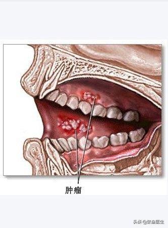 为什么台湾有槟榔西施，明明知道槟榔致癌，为什么还有那么多人吃槟榔