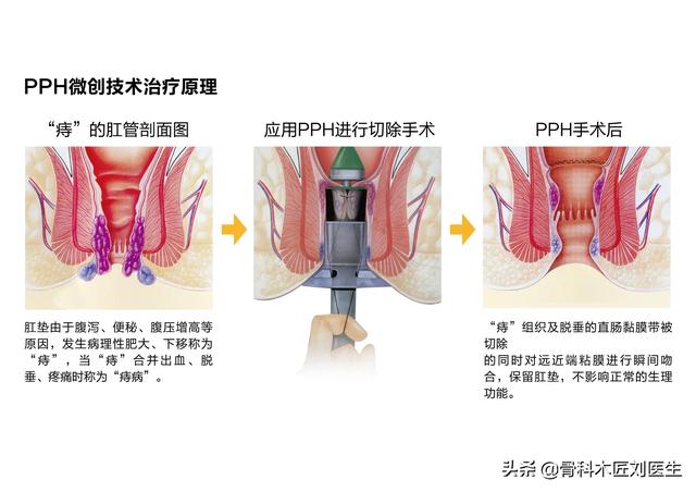 便血怎么治疗;便血怎么治疗比较好