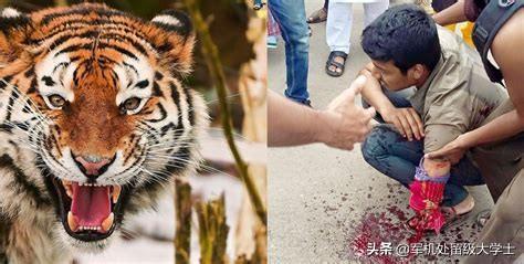 懒猴咬了一口用打针吗:被老虎咬了一口要去医院打针吗？