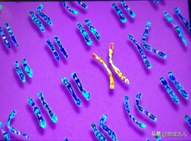 猫叫综合征:问一下人类的染色体有什么做用