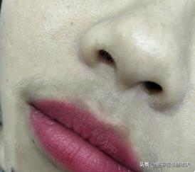 女生长小胡子:女生有唇毛(小胡子)是怎样的一种体验