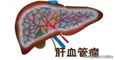 肝囊肿是怎么形成的，肝脏囊肿是什么原因引起的