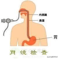 没有症状大便发黑:近几天我没有吃黑色食物，怎么排便会变黑色呢？