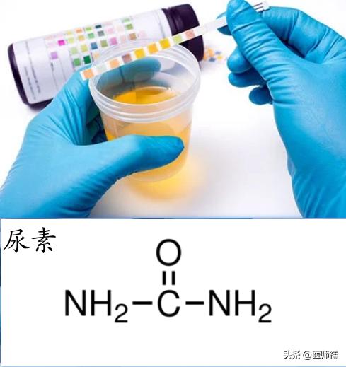 尿常规检查尿素高是怎么回事？