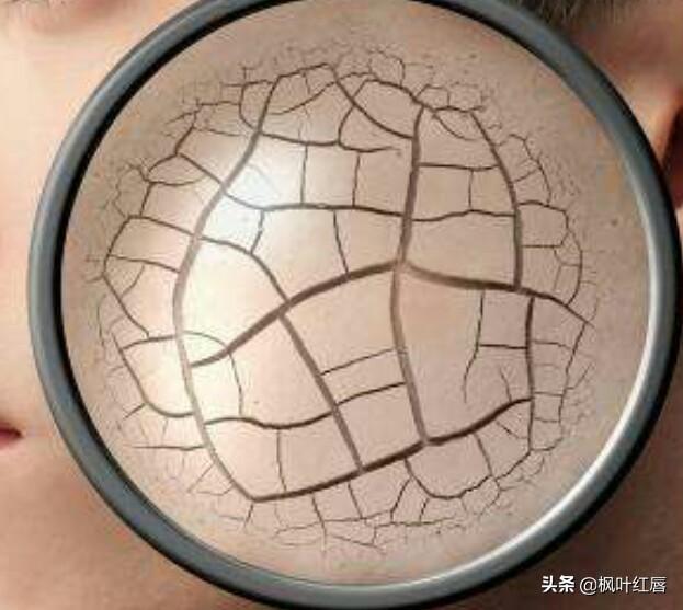 卡粉是什么意思:干性皮肤用遮瑕卡粉怎么办