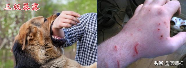 被猫抓伤多少天过危险期了:被猫抓超过3个月有狂犬病吗？