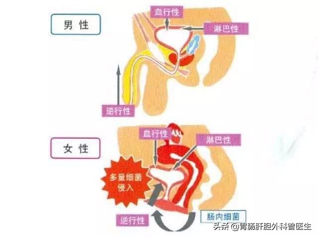 尿路感染长期不治会怎样 头条问答