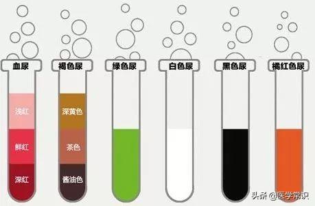 中医辨证小便很黄:断食期间小便怎么总是黄的？