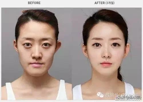 你是否接受明星整容？