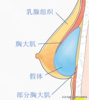 头条问答 女性的胸通过健身可以练大吗 79个回答