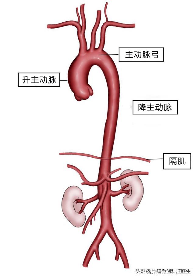 头条问答 升主动脉增宽和主动脉夹层是一回事吗 怎么样 9个回答