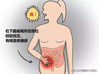 急性腹膜炎:胆囊结石是什么病，严重吗？