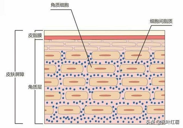 夏季皮肤问题图片:为什么一些人夏天皮肤过敏没冬天多？