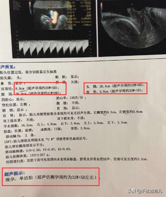 孕妇怀胎几月才能分娩:狗狗怀孕什么时候生，要做些什么？
