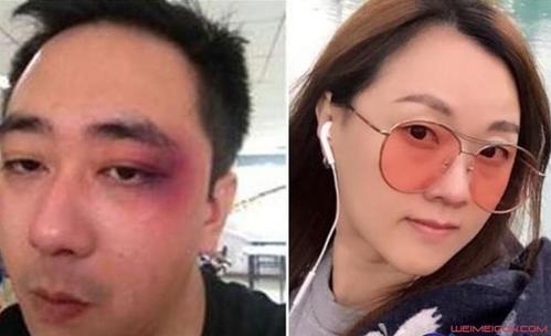 王自健散打冠军老婆:为何鼻青脸肿的王自健，和家暴的前妻不离婚？