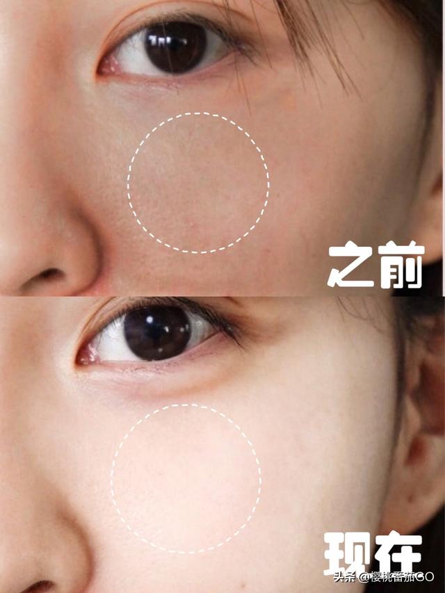 什么补水护肤品最好？有什么水乳套装推荐吗？