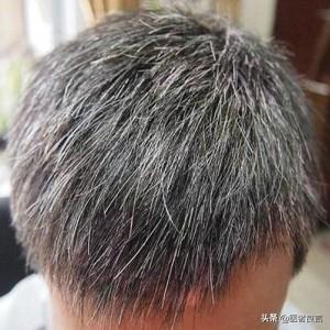 白头发与寿命有什么关系？