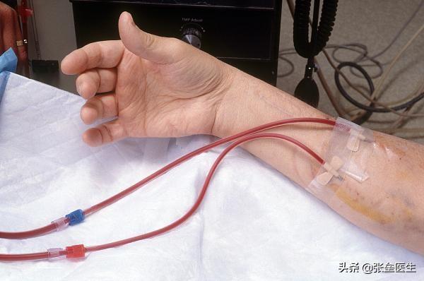 尿毒症很难医吗?为什么?-惠修网